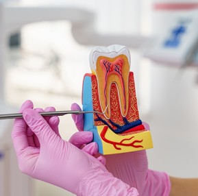 Endodonti (Kanal Tedavisi)